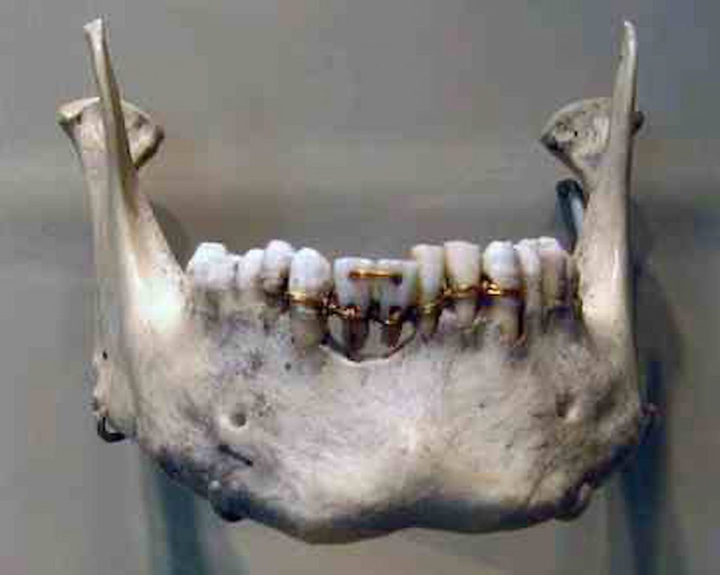Ancient Egypt Dentistry - Egypt