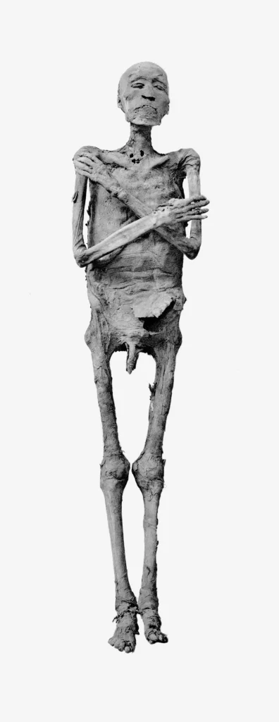 Ramesses IV Mummy