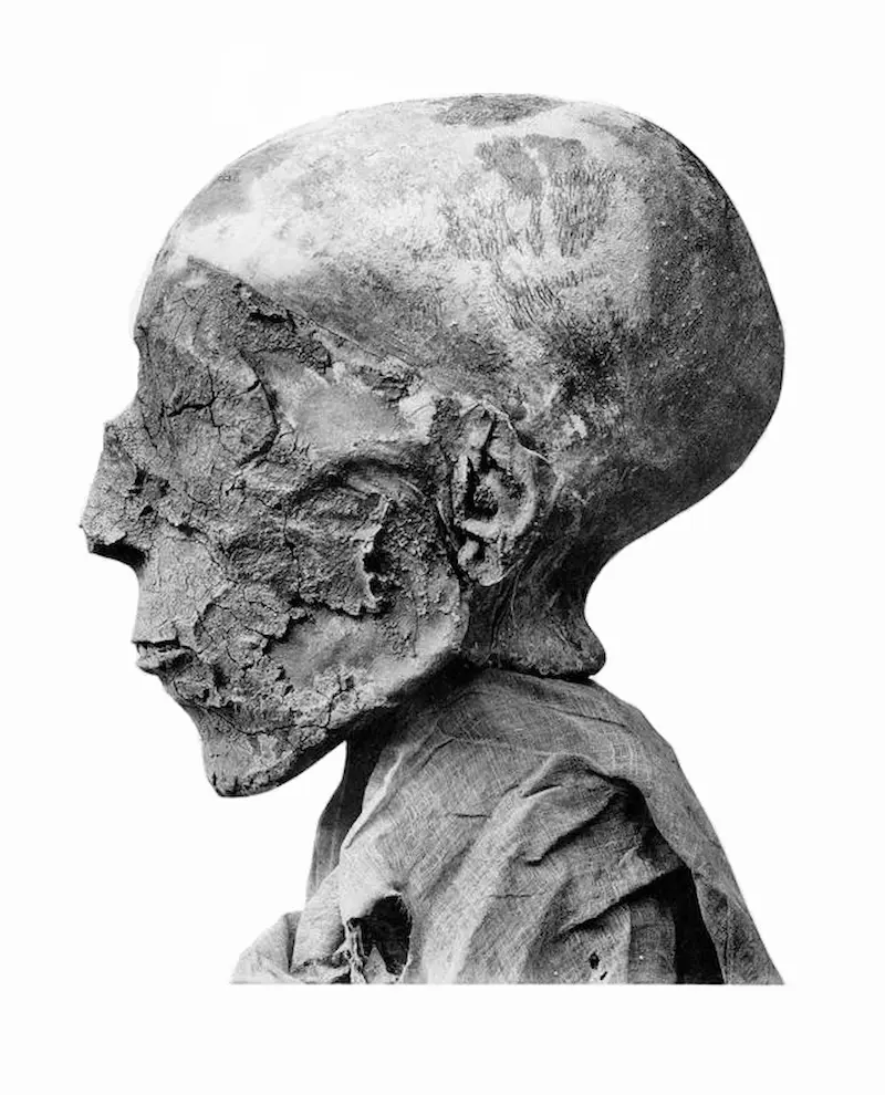 Seti II mummy head