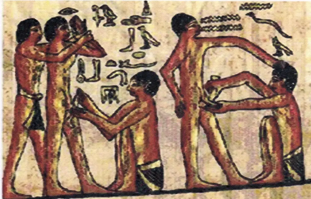 Egyptian Doctor treating laborers on Papyrus